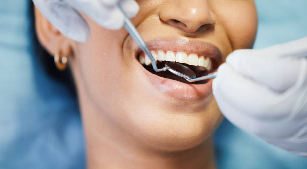 Best Broken or Cracked Tooth Emergency Dentist in Andrews, SC